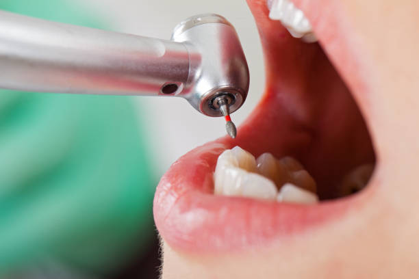 Best Emergency Dental Care for Broken or Chipped Teeth in Rogersville, AL